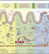 Image result for IBD Pathogenesis