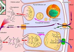 Image result for Jod-Basedow Syndrome