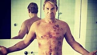 Image result for Shane Warne Before and After