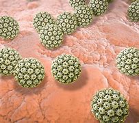 Image result for Human Papillomavirus Symptoms in Women