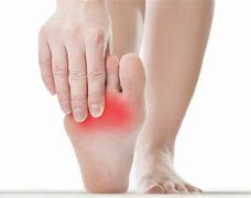 Image result for Bruise On Bottom of Foot