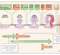 Image result for Colon Cancer Mutations
