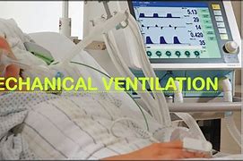 Image result for What Is Mechanical Ventilation