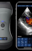 Image result for Portable Ultrasound Phone Scanner Android