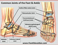 Image result for Metatarsal Navicular Joint
