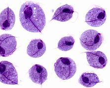Image result for Trichomonas Cell