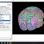 Image result for Detailed Brain Anatomy