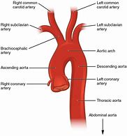 Image result for Carotid Arteries Diagram