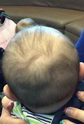 Image result for Toddler Bump On Head