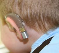 Image result for Hearing Devices