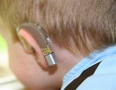 Image result for Hearing Devices