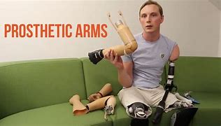 Image result for Full Arm Prosthetic