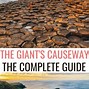 Image result for Giant's Causeway Ireland Map
