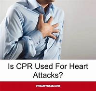 Image result for Heart Attack CPR