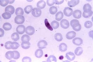 Image result for Blood Parasites