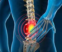 Image result for Back Pain Chiropractor