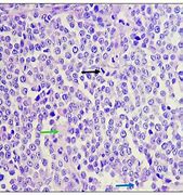 Image result for Papilloma Dog Skin