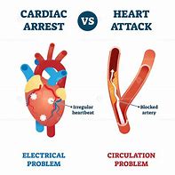 Image result for Cardiac Arrest Icon