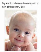 Image result for Funny Skin Memes