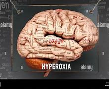 Image result for hiperoxia