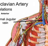 Image result for Subclavian Artery