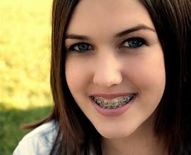 Image result for Wearing Braces