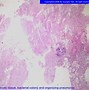 Image result for wctinomicosis