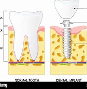 Image result for Lower Jawbone