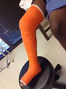 Image result for Broken Leg Cast Wheelchair