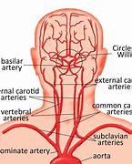 Image result for Internal vs External Carotid Artery