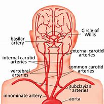 Image result for Picture of Carotid and Vertebral Arteries