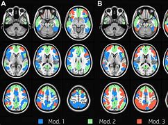 Image result for Prospective Memory Tasks