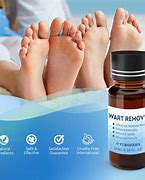 Image result for Wart Treatment Solution