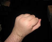 Image result for People with No Knuckles