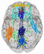 Image result for Brain Connectivity