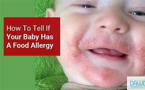 Image result for Baby Food Allergy Apple