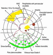 Image result for Retina Drawing Chart