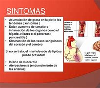 Image result for hiperlipidemia