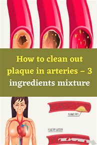 Image result for Clean Arteries of Plaque