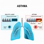 Image result for Allergy Induced Asthma