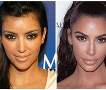 Image result for Plastic Surgery Face Change
