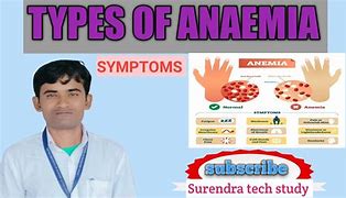Image result for Hasil Lab Anemia