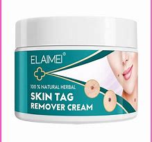 Image result for Mole Wart and Skin Tag Removal