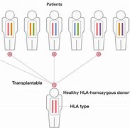 Image result for Homozygous Individual