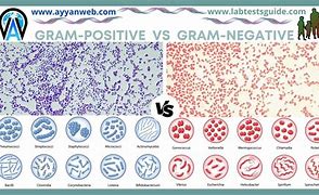 Image result for Gram-positive vs Negative