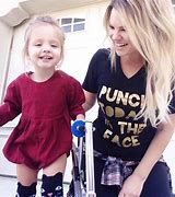 Image result for Mild Cerebral Palsy