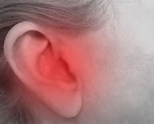 Image result for Pain above Ear