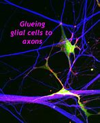 Image result for Axon Brain