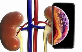 Image result for iPhone 14 for Kidney Funny Meme