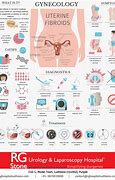 Image result for Uterine Fibroids in Uterus Nursing Diagnosis